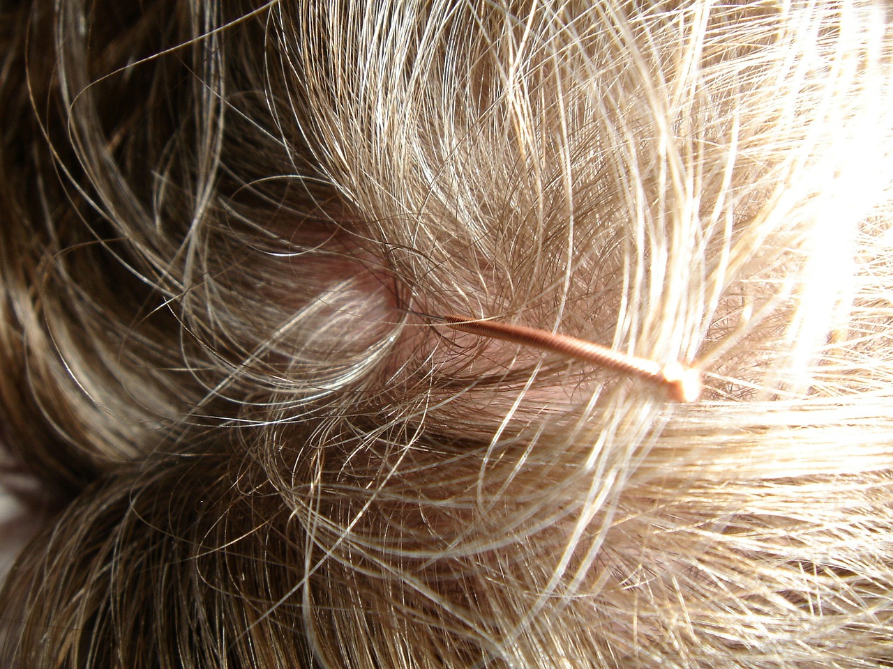 scalp