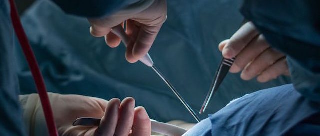 Kidney Transplant