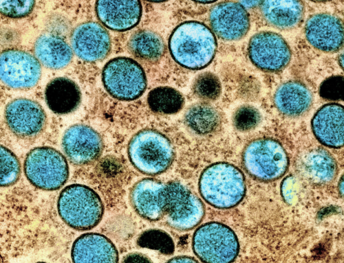 U.S. declares monkeypox outbreak a public health emergency
